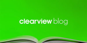 5 Things to Consider When Developing a Deep Learning System